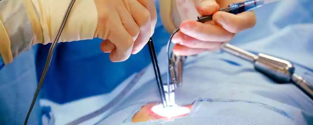 laser proctology